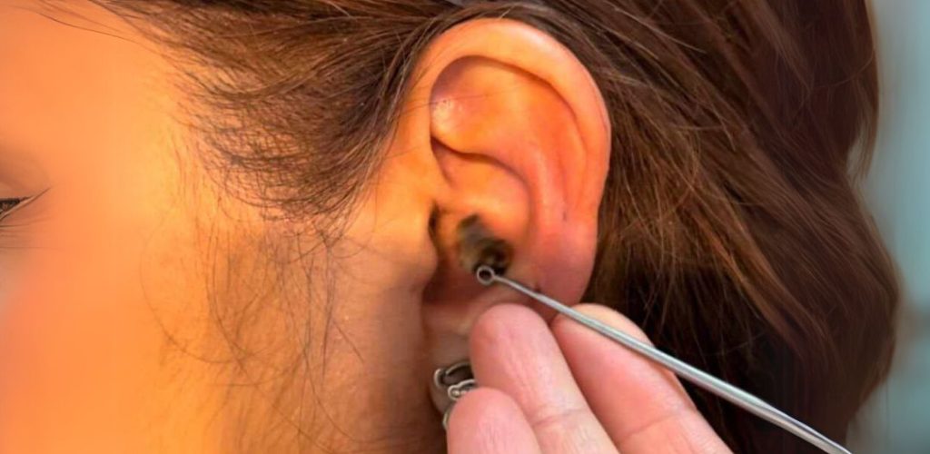 cureta de cerumen